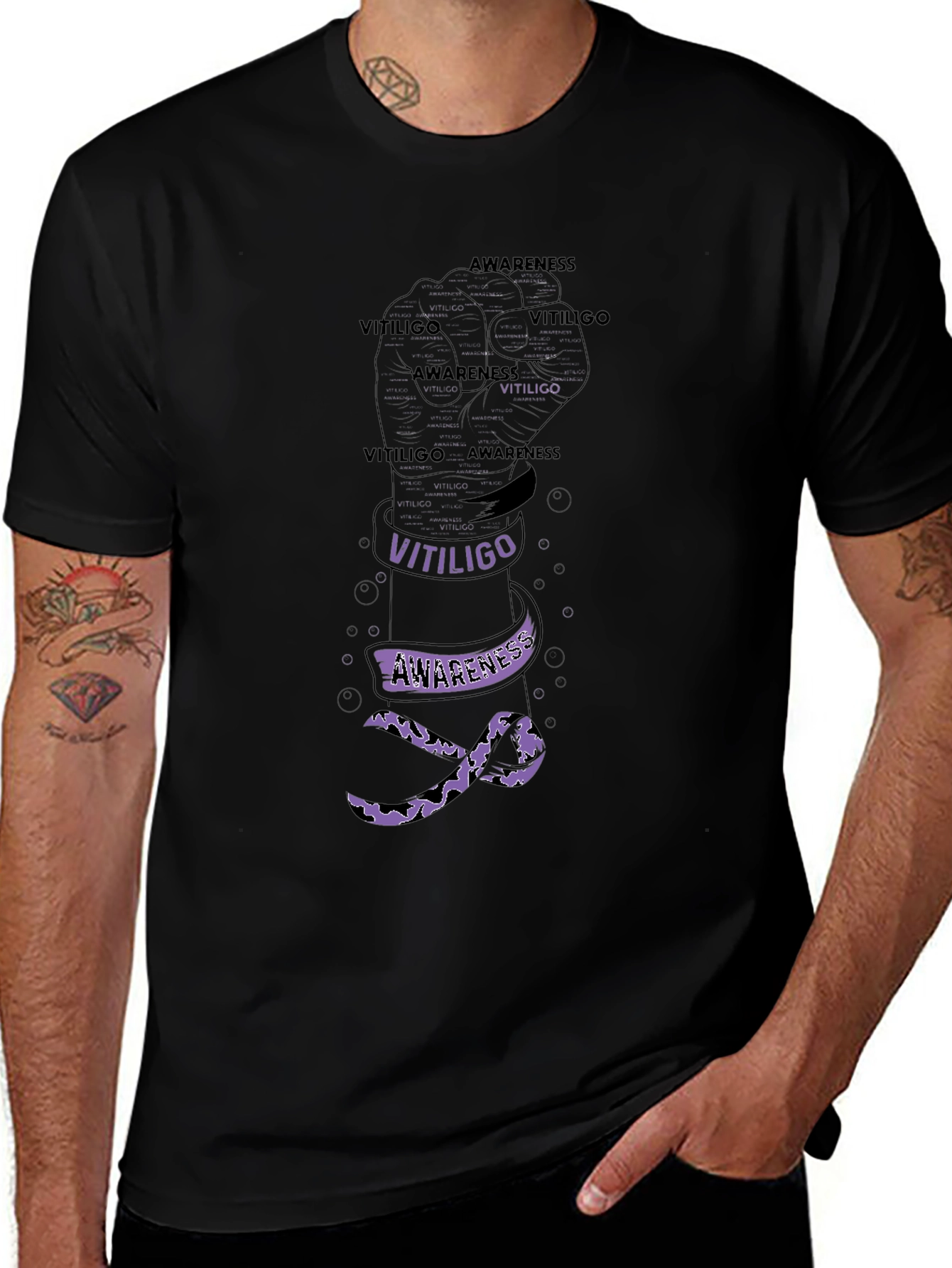 Vitiligo Awareness Fist T-Shirt