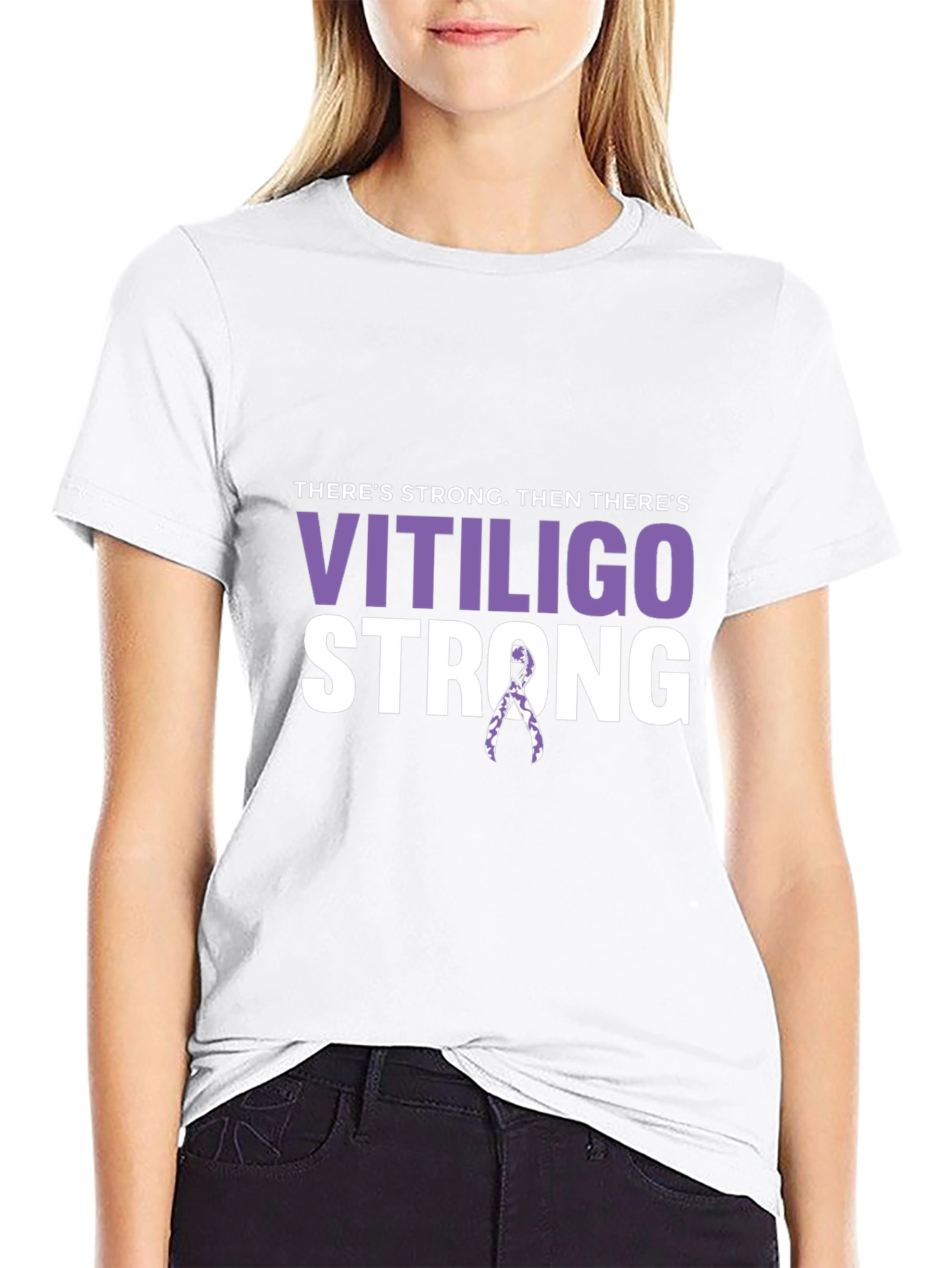 Vitiligo Strong T-Shirt - Awareness Support Tee